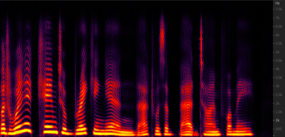 Spectrogram